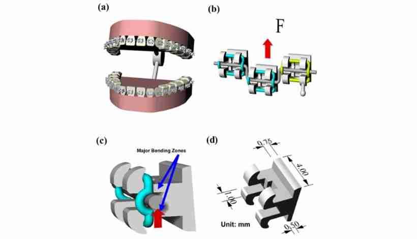 MIM orthodontic brackets produced by Emitech